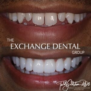 Transformation Three | The Exchange Dental Group