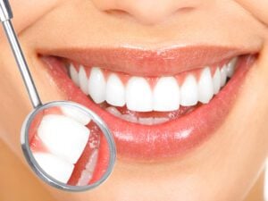 zoom in of a bright white smile